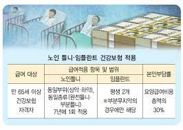 임플란트 가격