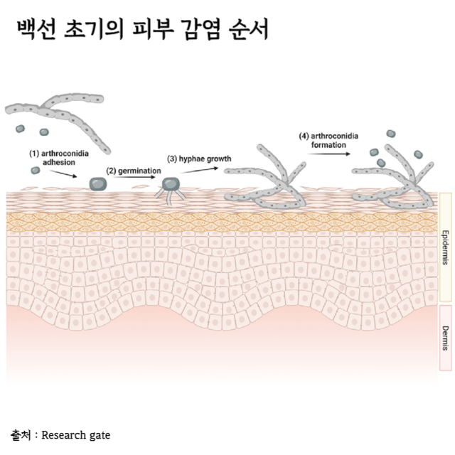 백선-치료