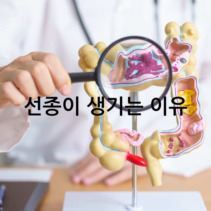 대장 용종과 선종의 차이점부터 예방법