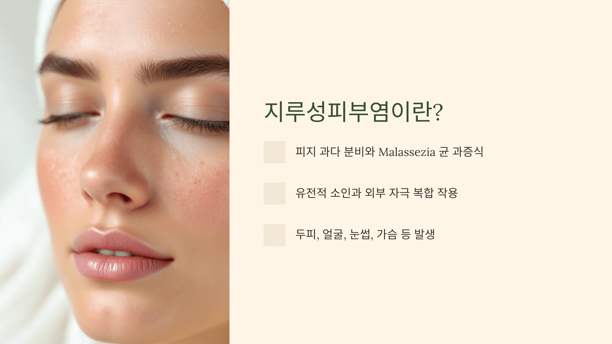 지루성피부염