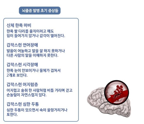 뇌졸중 전조증상과 체크리스트 및 예방과 치료