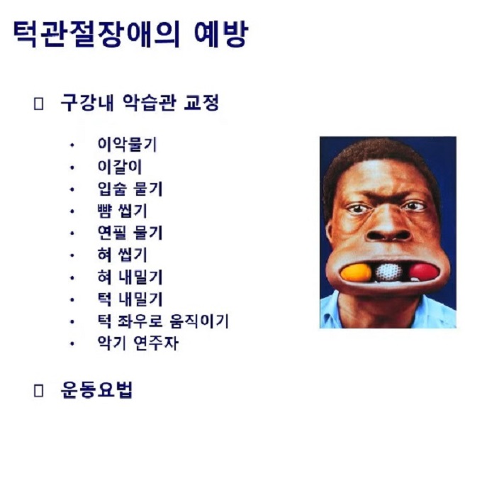 EBS명의-턱관절-고홍섭-교수