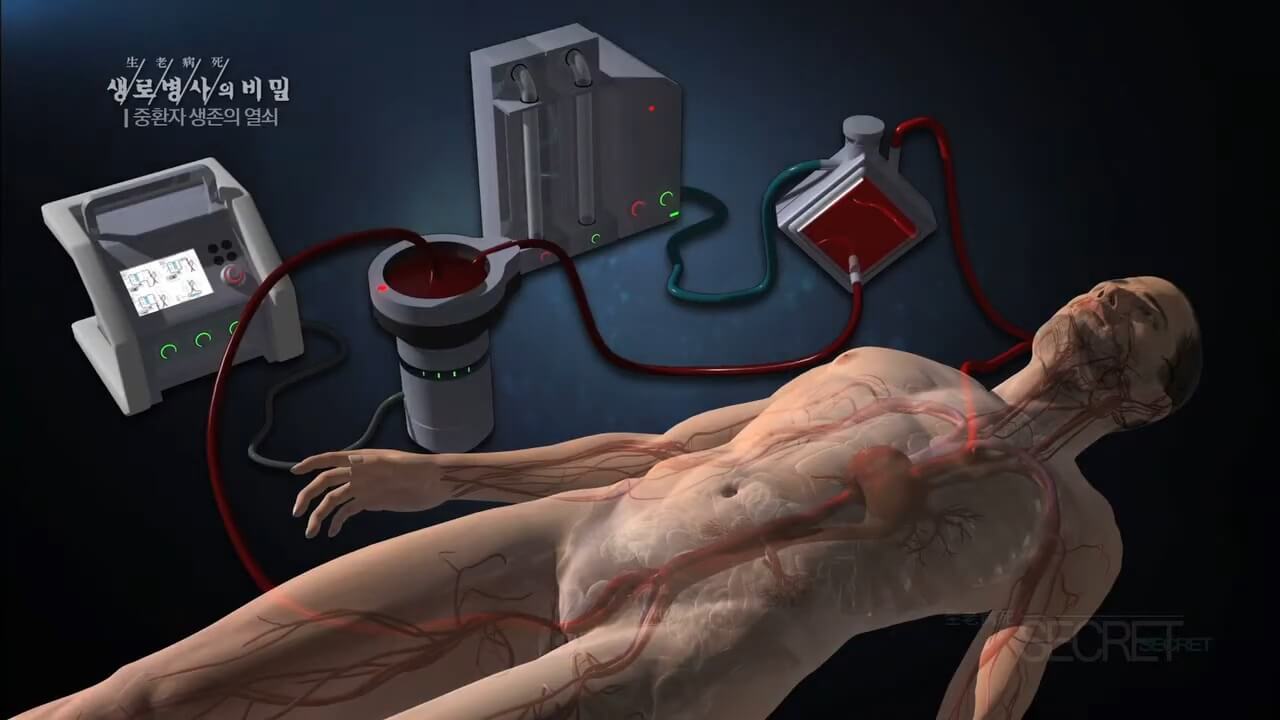 체외순환사-하는일-연봉-자격조건확인하기