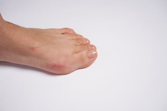 미카수술(MICA 수술) │ 무지외반증의 새로운 최소절개 교정술