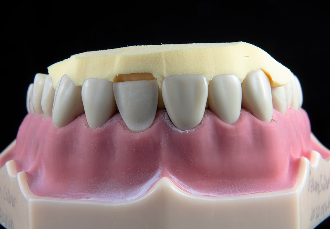 implant