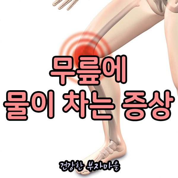 무릎에_물이_차는_증상