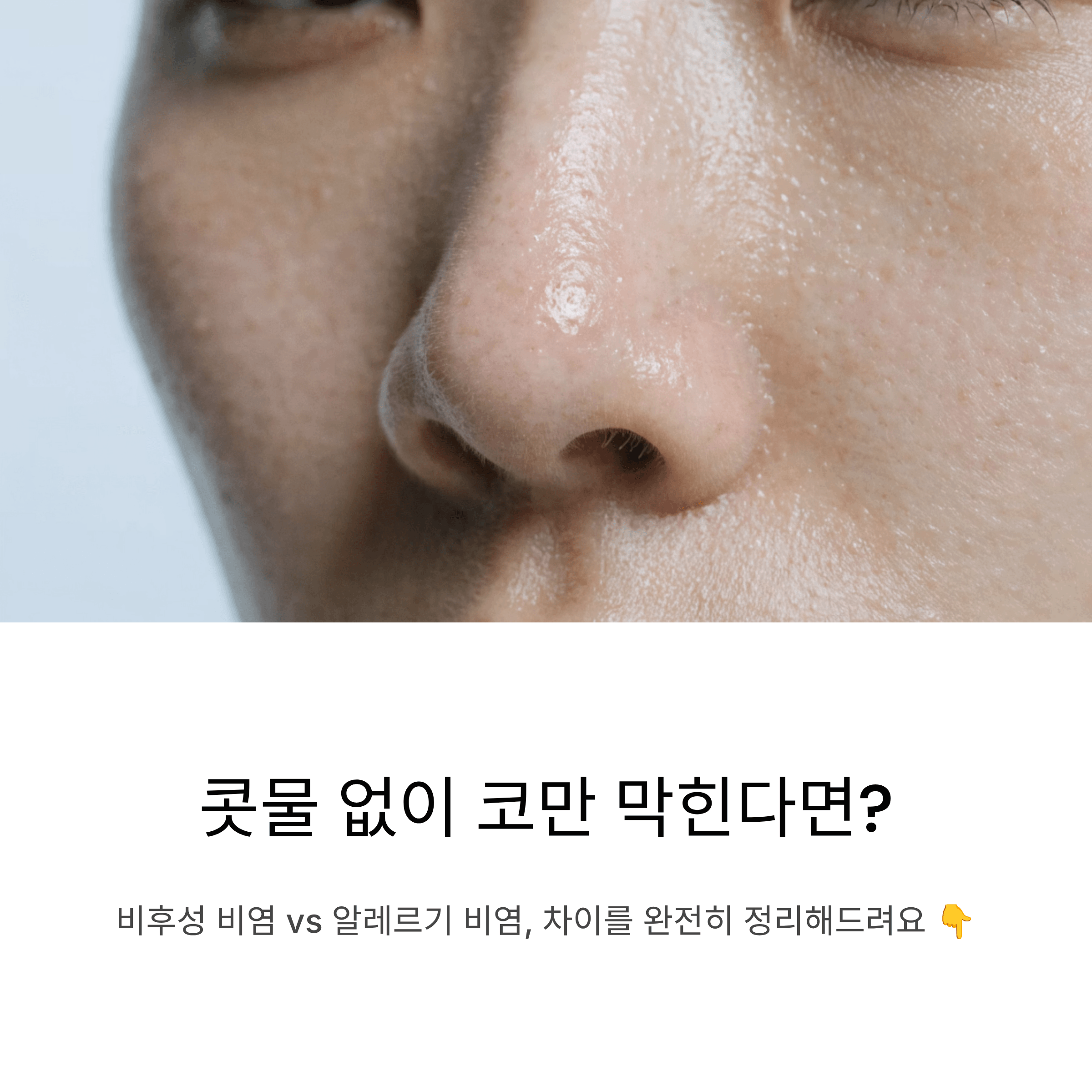 코막힘만 있고 콧물은 없다면 비후성 비염과 알레르기 비염 차이 완전 정리