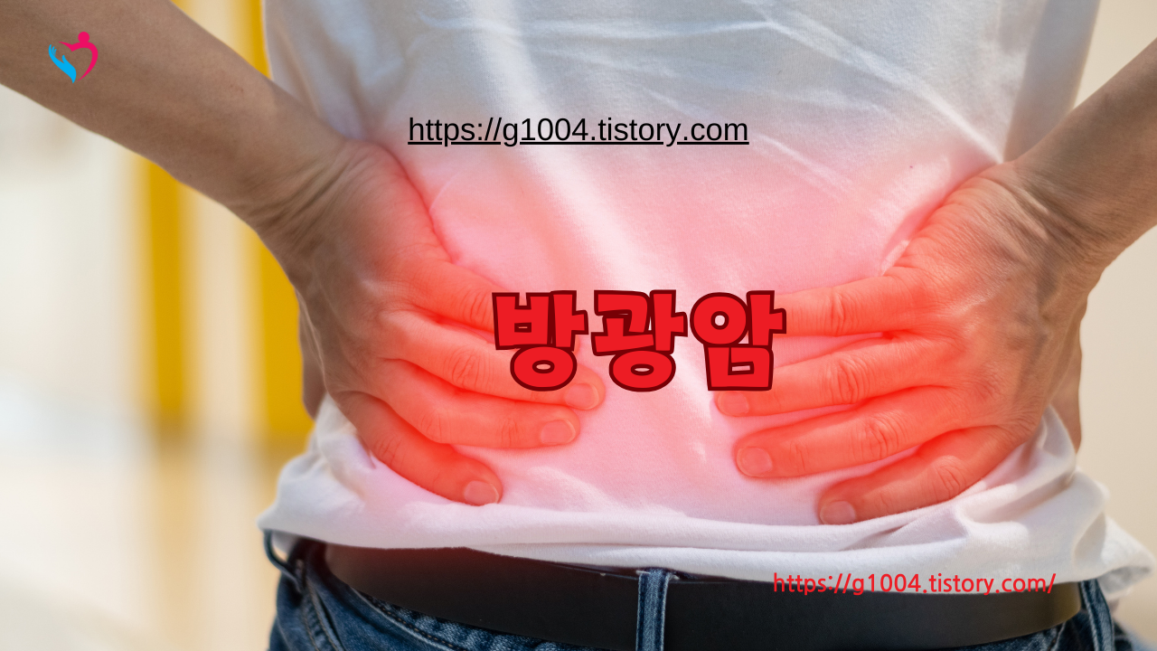 방광암