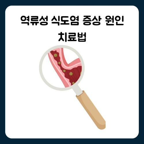 역류성 식도염 증상 원인 치료법