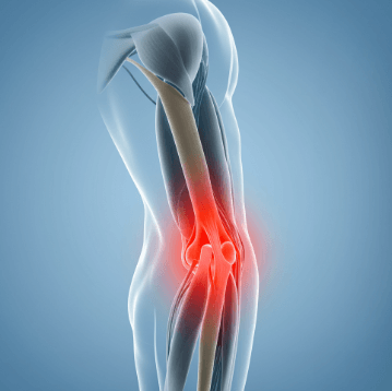 팔꿈치 통증 원인과 치료법3