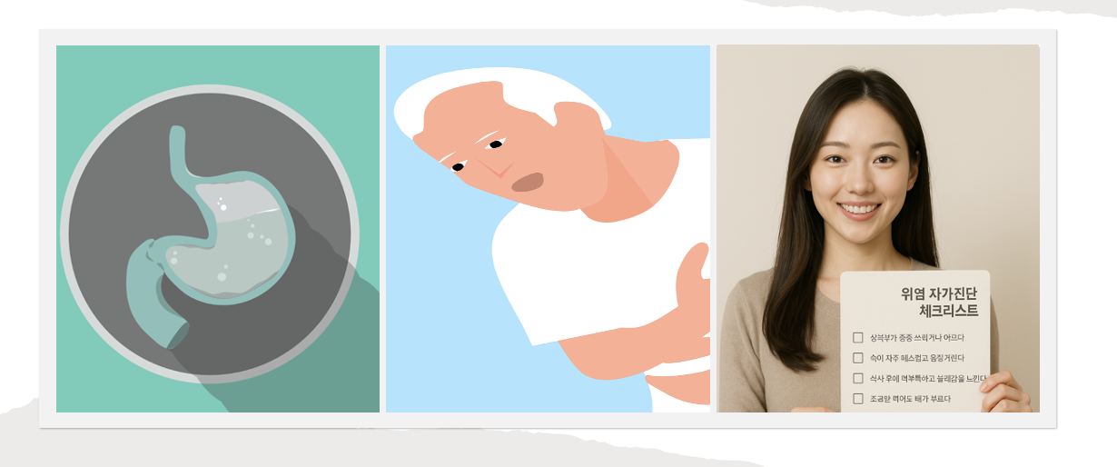 여름철 위염 주의보