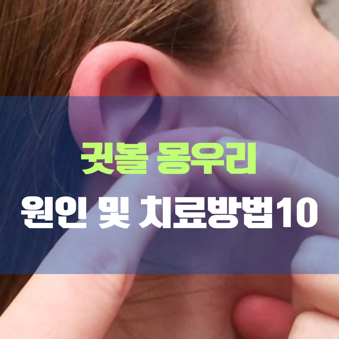 귓볼 몽우리 원인과 치료 방법 10가지 및 귀뒤 피지낭종과의 연관