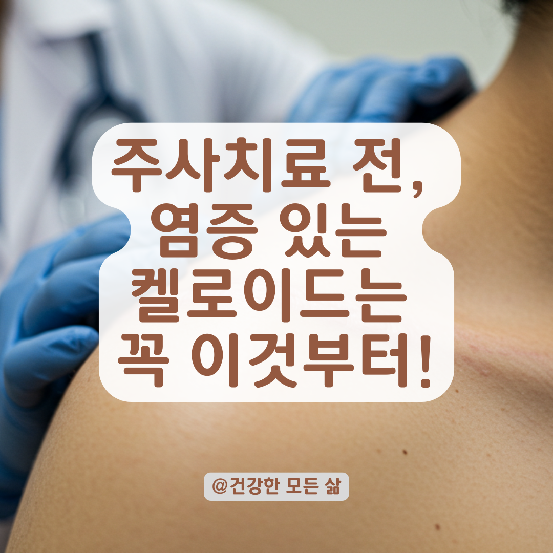 오래된 켈로이드가 가렵고 커진다면, 주사치료 전 이것 꼭 확인하세요
