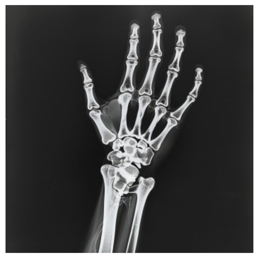 손가락마디통증과 관련된 사진입니다.