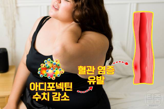 혈압 낮추는 법 다이어트 비만 고혈압 상관관계 아디포넥틴