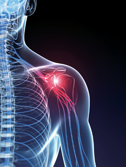 어깨 통증 원인