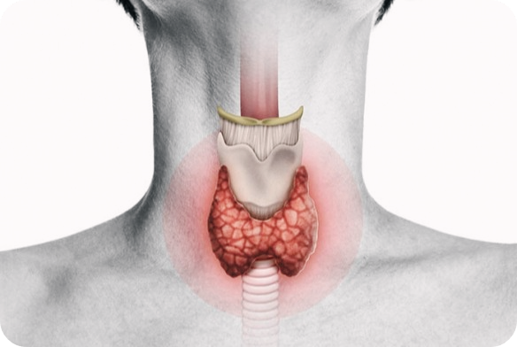 눈밑이-떨리는-증상