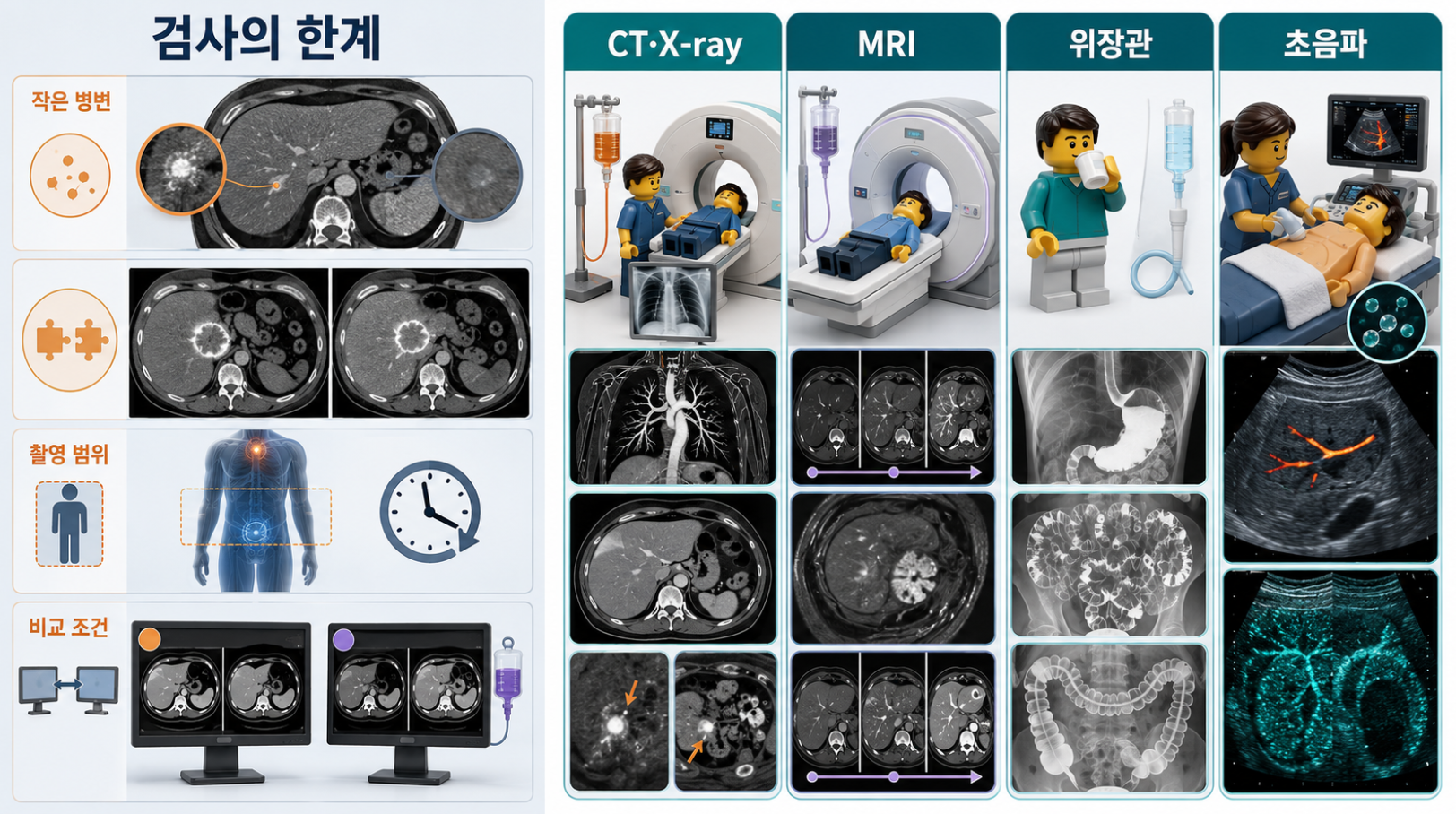 조영검사의 주요 한계와 CT·X-ray·MRI·위장관·초음파 조영제 역할 비교