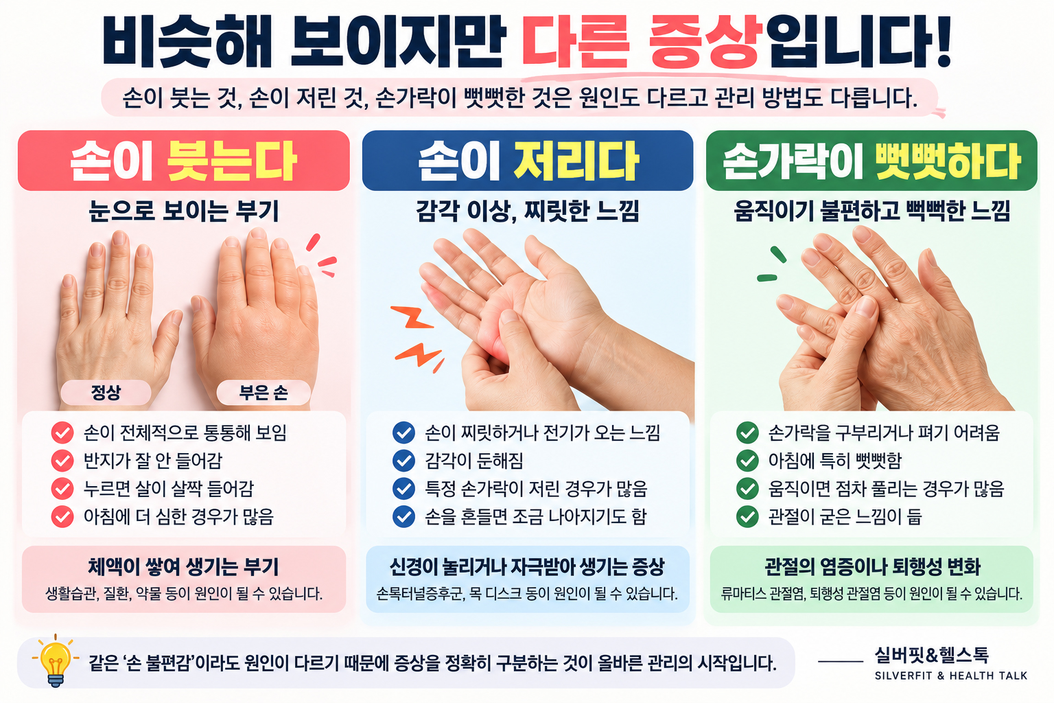 손이 붓는 것과 손이 저린 것, 손가락이 뻣뻣한 증상의 차이를 비교한 이미지
