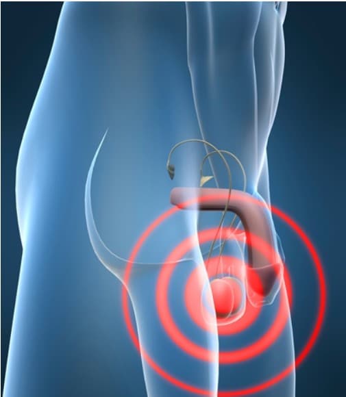 카리토포텐 효능