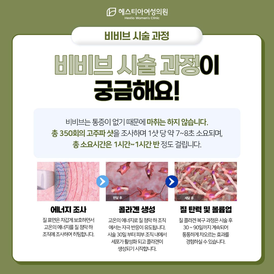 비비브의 시술 과정이 궁금해요!