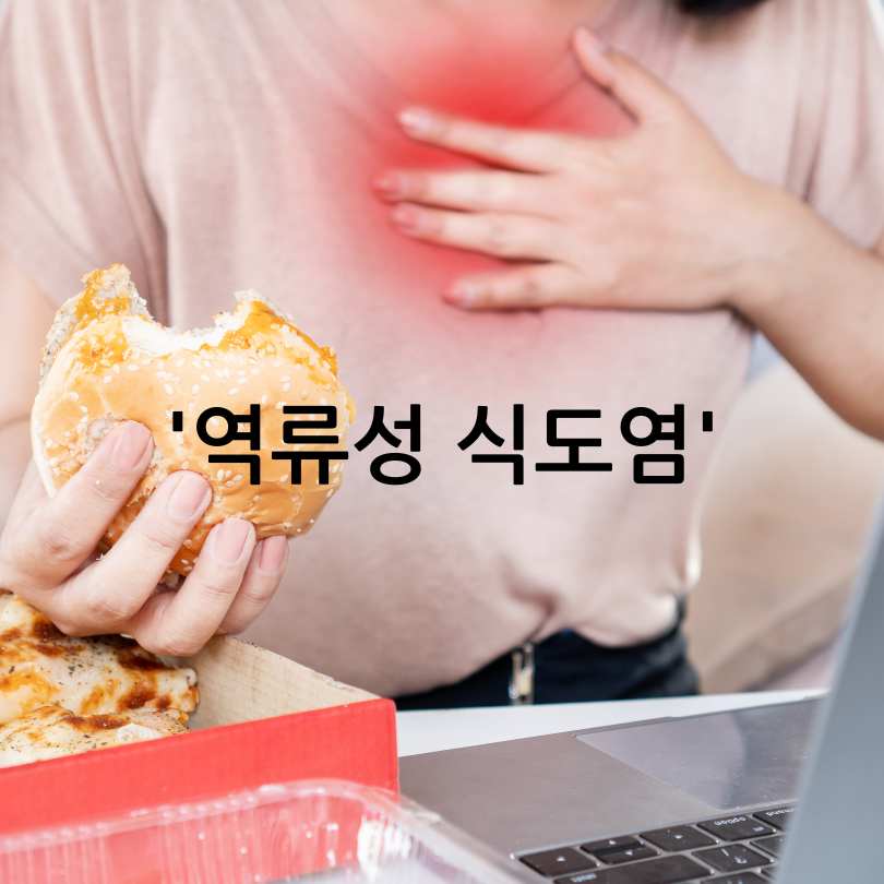 역류성 식도염 증상 총정리