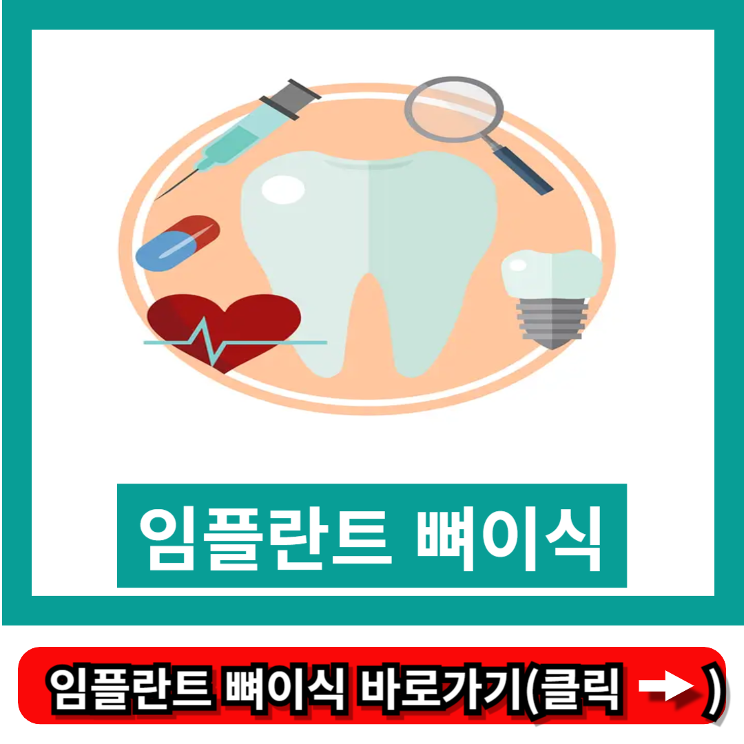 임플란트 뼈이식