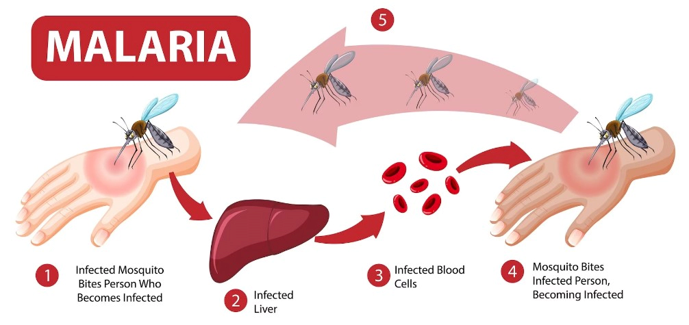 말라리아 증상 10가지