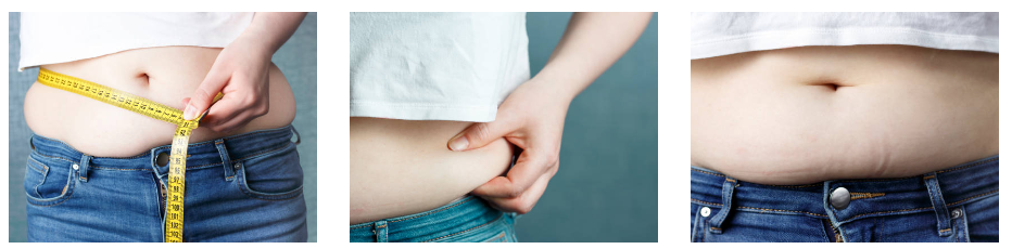 대사증후군 원인, 증상, 치료, 예방, 질병코드 : 당신이 알아야 할 모든 것