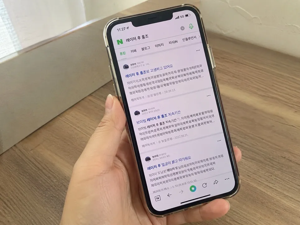 스마트폰으로 네이버 검색창에 레이저 후 홍조를 검색하여 나타난 뷰(VIEW) 탭 검색 결과를 손으로 들고 보고 있는 모습