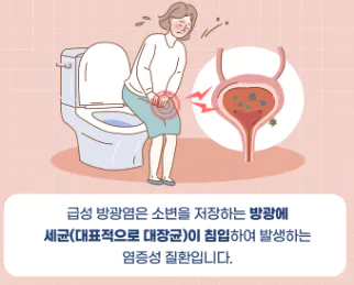 방광염-뜻