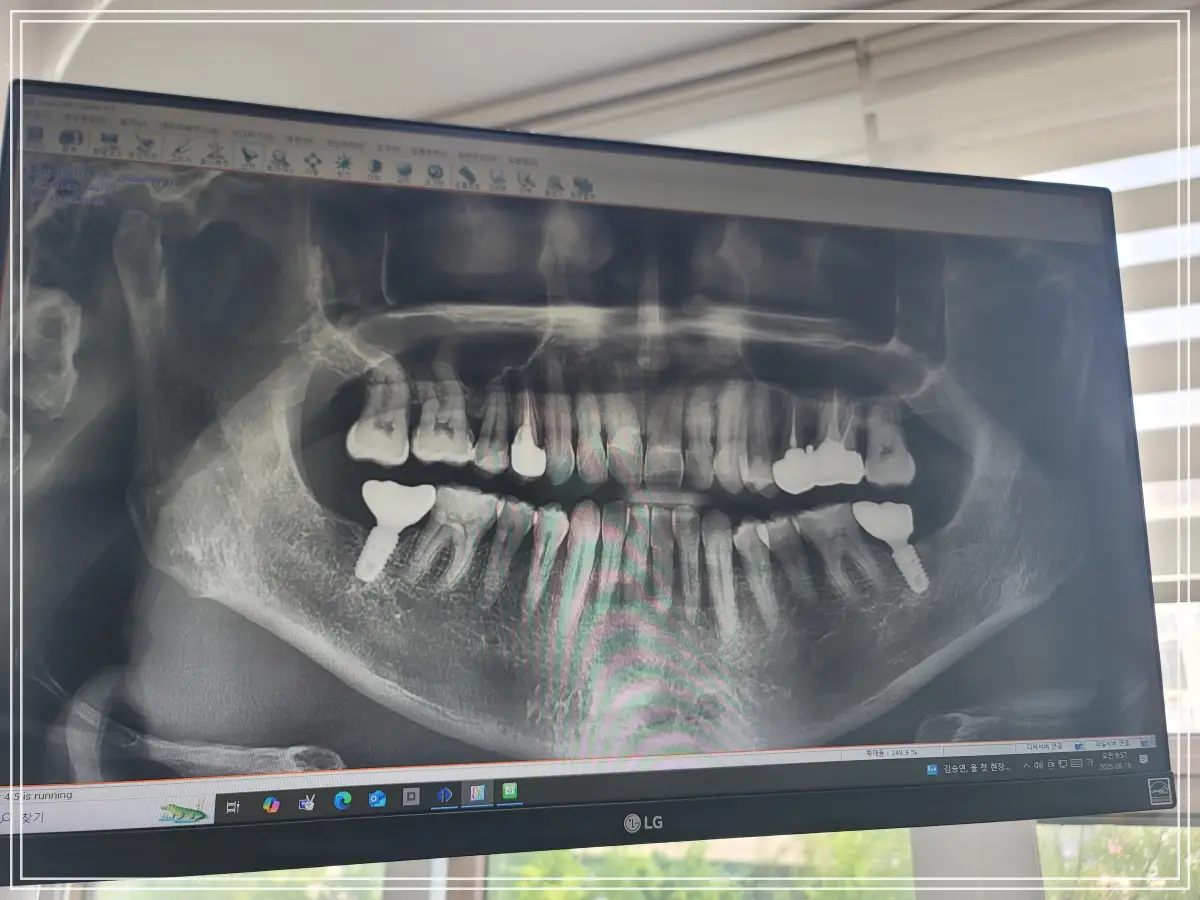 batch_KakaoTalk_20250618_130847918_03