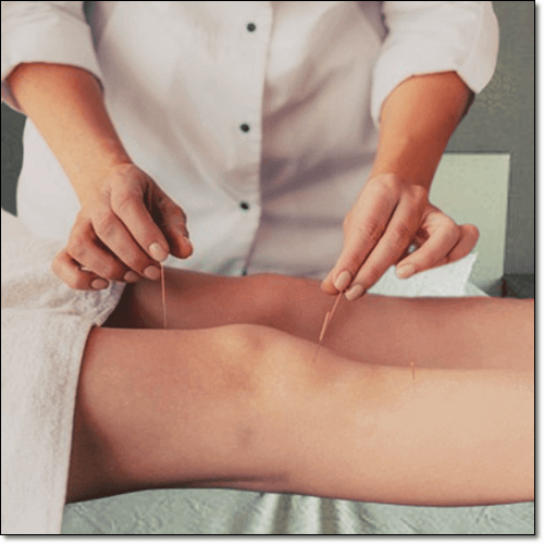 베이커 낭종 치료