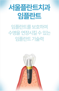 서울 임플란트
