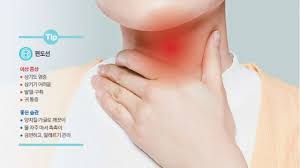 편도염 빨리 낫는법