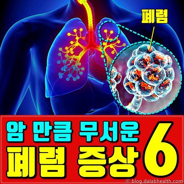 폐렴 증상,폐암