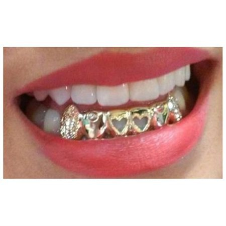 금니 팔기 전 시세 확인하기