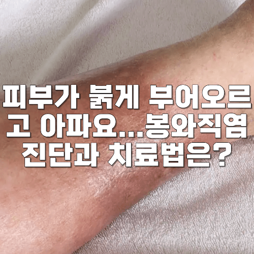 봉와직염