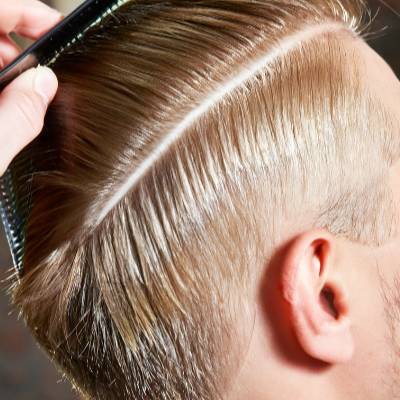 2. 두피 각질 제거