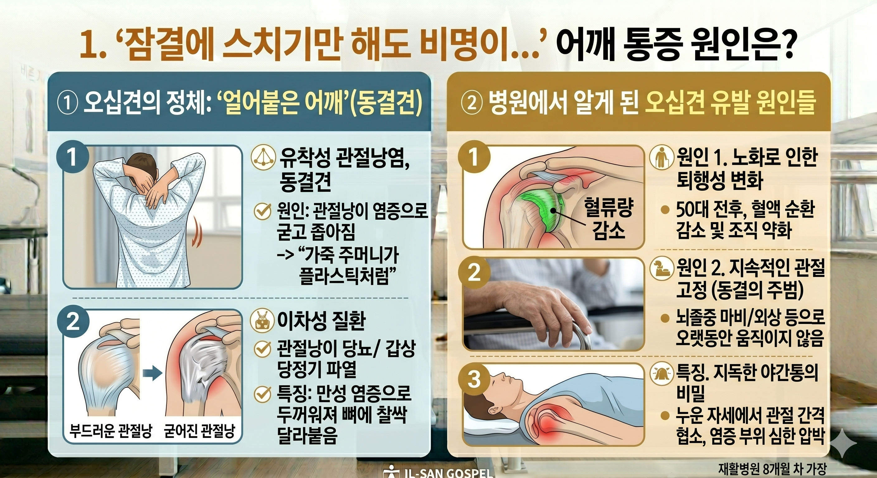 "잠결에 스치기만 해도 비명이..." 어깨 통증 원인은?