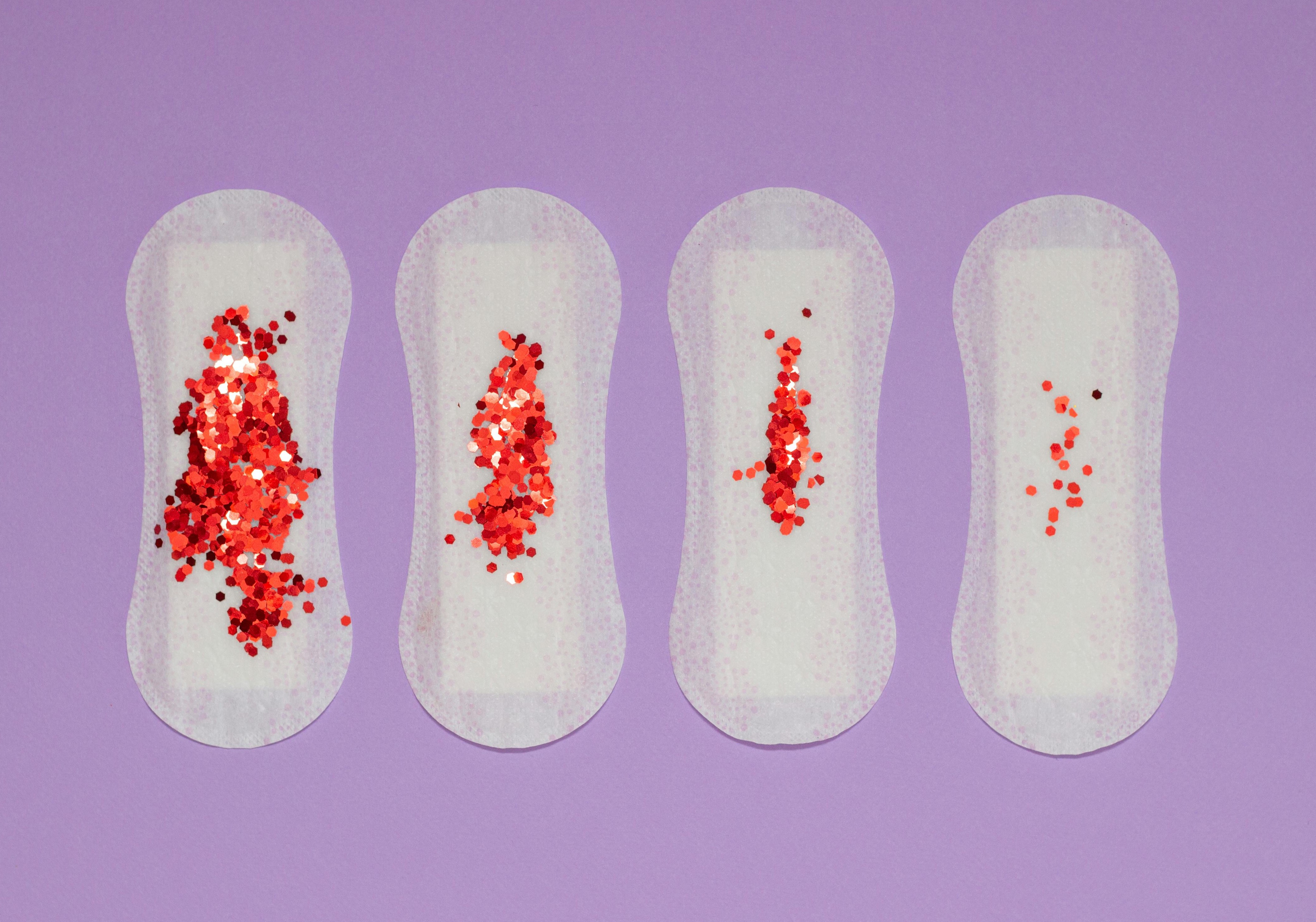 생리 늦어지는 이유 TOP7-임신 아니어도 이런 원인이?