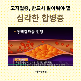 고지혈증 초기증상 및 관리법