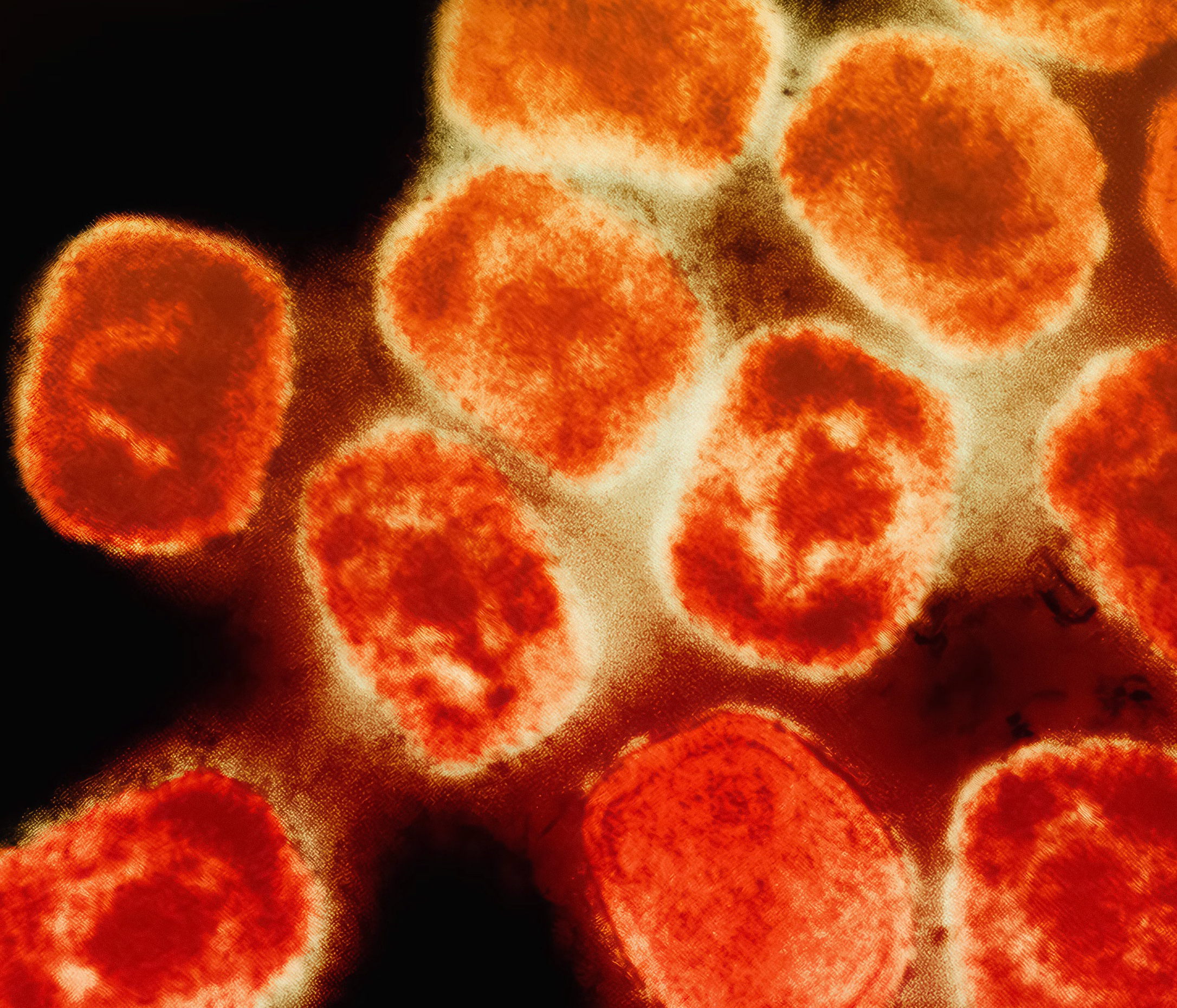 헬리코박터균 약