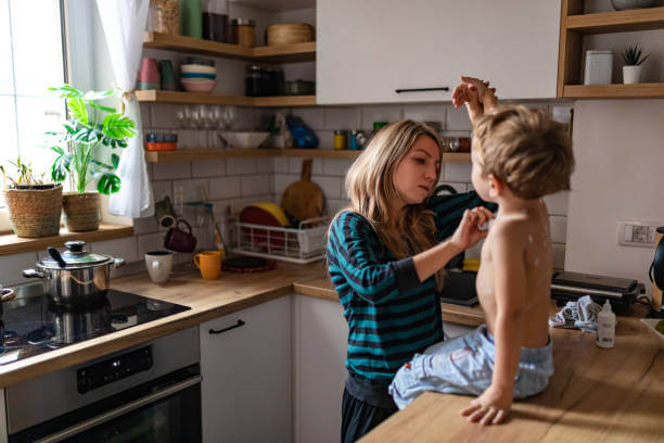 대상포진 예방접종 비용확인 초기증상 치료
