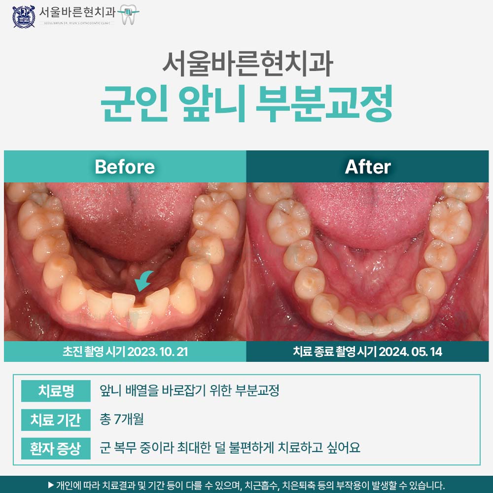 부산군인교정