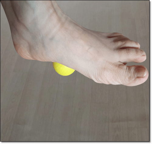 족저근막염 자가 물리 치료