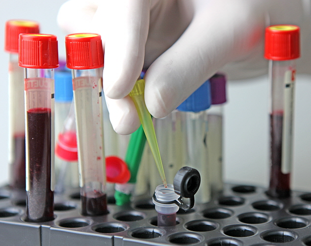 표적치료제와 유전자 검사 필요성