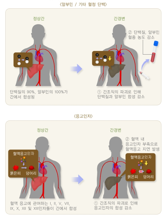 간기능 검사 정상수치4