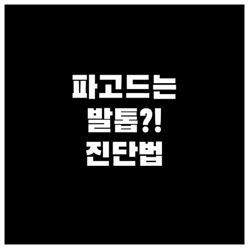 당신의 발톱, 안전한가요? 파고드는 