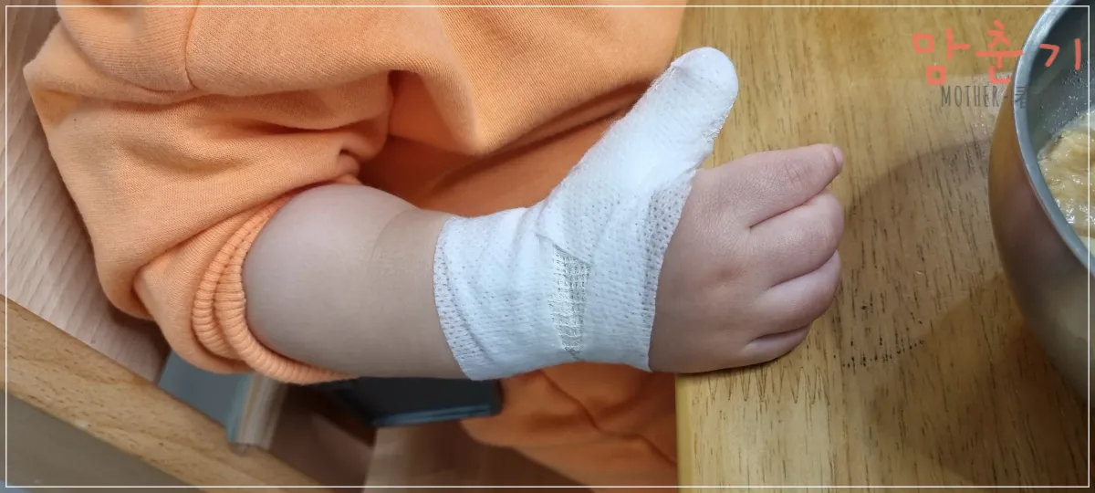 아이-2도화상-엄지손가락-드레싱한-모습